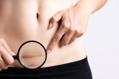 No Name Project (46) Helppo Resize.com