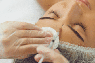 Mikä on Relfydess Botox