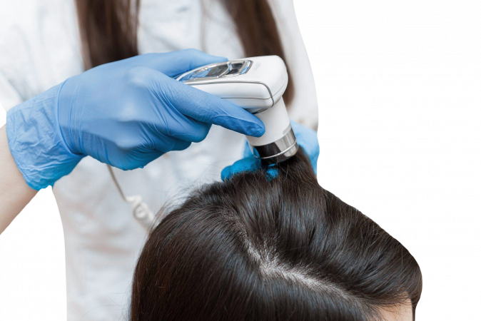 VIP-trikologinen hoito